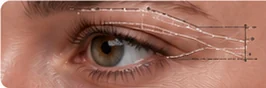 Oculoplastia