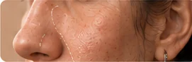 Otorrinolaringología estética